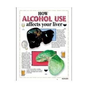  How Alcohol Use Affects Your Liver Framed Chart