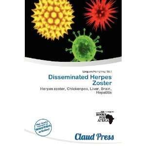  Disseminated Herpes Zoster (9786200724243) Lóegaire 