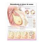   Chart in Spanish/Entendiendo El Cancer De Mama by Anatomical Chart