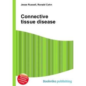  Connective tissue disease Ronald Cohn Jesse Russell 