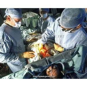  Surgeons perform triple bypass surgery on heart Framed 